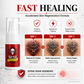 🎨 50% OFF | Tattoo Aftercare Moisturizing Spray 💧 Hydrating Mist for Vibrant & Healthy Ink