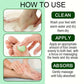 🥳2026 HOT SALE🥳💞50K+ SOLD!✨ 💝Soothing Aloe Vera & Tea Tree Foot Moisturizer