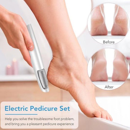 🔥Hot Sale - 50% OFF🔥Electric Feet Callus Remover⚡